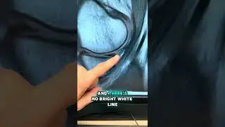 WILL A BRUISED MENISCUS HEAL?