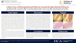 Retroperitoneal fibrosis caused by IgG4 RD