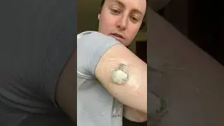 Medtronic 780g sensor change #typeonediabetes #medtronic780g #insulinpump