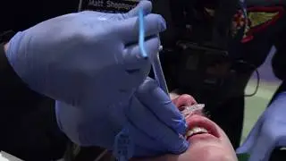 Matt attempts an intubation procedure on a young boy