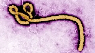 An Ebola Update From the Desk of Dr. Anthony Fauci
