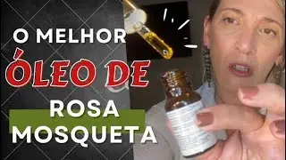 OS BENEFÍCIOS DO ÓLEO DE ROSA MOSQUETA // PELE MADURA