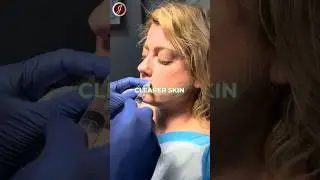 Botox by Dr. J Anti-Aginig Clinic, Orlando.