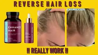 Fully Vital Hair Growth System!