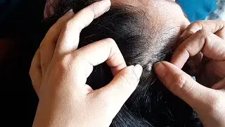 😊🌜 Scalp checking Video | Soothing Video 😴🥱