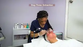 What is a Hydrafacial? Step by Step procedure, Before and After results!