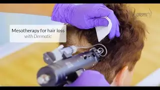 DERMATIC mesotherapy gun for hair loss