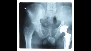 X Ray Homeopathic Remedy described by Dr Rajiv Karia Part 4 as on 27/05/2020