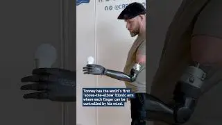 The world's first above-the-elbow bionic arm! #sweden #medtech #innovation #bionics