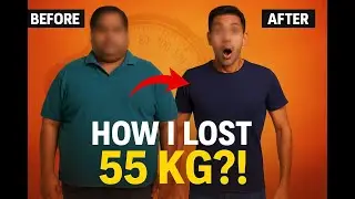 Bariatric Surgery and Allurion Balloon Support Group - Dr Rajat Goel #weightlossjourney