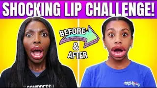 We Got Lip Injections!