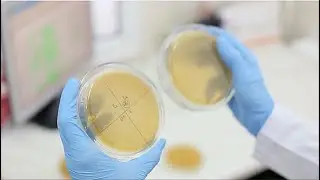 MicroGenDX - Using NGS to Improve Patient Outcomes