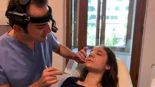 Op. Dr. Ali Murat Akkuş- Rinoplasti sonrası silikon tampon çıkarılması