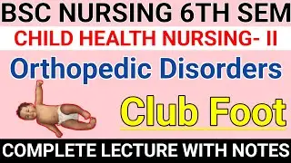 CLUB FOOT: TYPES, CAUSES, SYMPTOMS & MANAGEMENT IN SHORT NOTES| QUICK LEARNING SERIES BY VR EDUCATOR