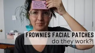 Frownies Facial Patches Review (Do Frownies Facial Patches Work?!)