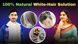 White Hair Problem and Solution | Adeoga Max
