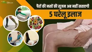 Leg Pain Relief: पैरों की नसों की समस्या का इलाज | 5 आसान घरेलू उपाय