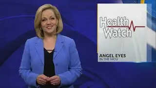 Health watch: Angel eyes in the NICU