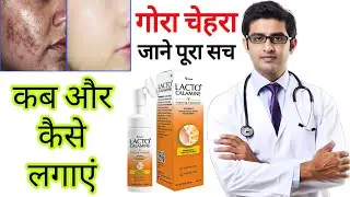 Lacto calamine face wash HONEST review 2025 in hindi | how to use lacto calamine face lotion