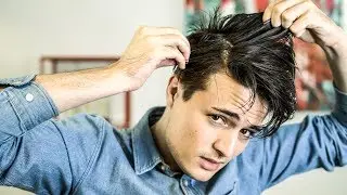 Men's Hair Tips | How to Get Rid of Dandruff