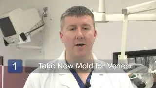 How to Repair a Porcelain Veneer on Teeth
