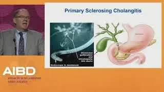 Hepatobiliary manifestations and IBD