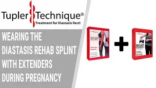 Wearing the Diastasis Rehab Splint with Extenders during Pregnancy - Julie Tupler, RN