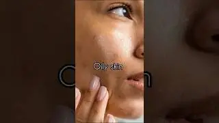 Toner I use for oily skin