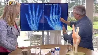 Pijnlijke gewrichten - KOFFIETIJD