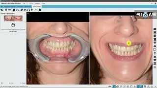 [Rimas Engineering] Maestro 3D - Dental Studio Smile Creator
