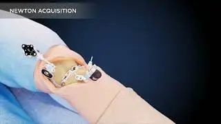 GPS Knee Animation: Newton Balancing Technology