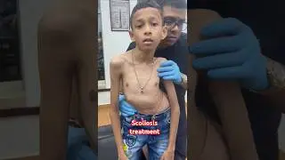 #Scoliosistreatment  #drrajneeshkant  #rkm
