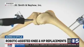 New technology for knee and hip replacements
