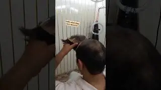 clipping hair patch for men #shorts #nicehairwig