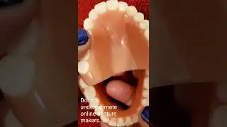 Gorgeous online purchase #dentures #shorts