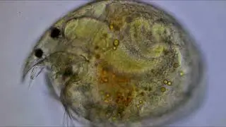 #40.1 Chydorus sphaericus, a beautiful crustacean.