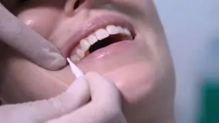 How to use Interdental Brushes