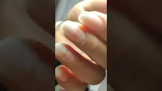 Corectie unghii convexe Slim Nails Roma Grottaferrata