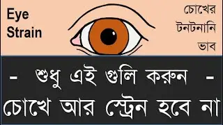 How to avoid eye strain: #eyestrain #dryeye #doctorsight #howToPreventEyestrain