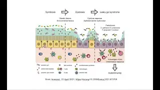 PERCHE'  TUTTE LE MALATTIE HANNO ORIGINE NELL'INTESTINO?