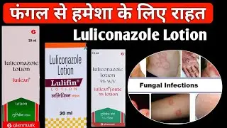 luliconazole lotion | luliconazole lotion 1 w/v | luliconazole cream | lulifin lotion | lulican