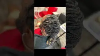 Suffering with alopecia, don&rsquo;t give up hope! #hairloss #locextensions #transformation #locs #dreads￼