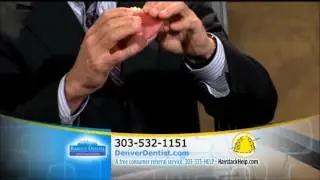 Lock Down or Replace your Dentures at Barotz Dental in Denver, Colorado