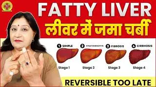 Fatty Liver Grade 1, 2, 3 | Causes, Symptoms & Acupressure Treatment
