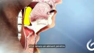Eau p&eacute;tillante & troubles de la d&eacute;glutition : le t&eacute;moignage de LADAPT Loiret 💧