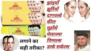 Myfair Cream Kaise use karna hota hai || Myfair Cream Review || कब और कैसे लगाएं