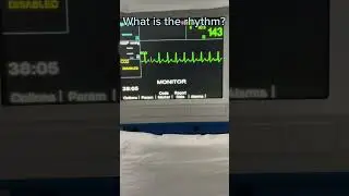 What is the rhythm? EP.8 #shorts #ekg  #ecg #frontlineekg