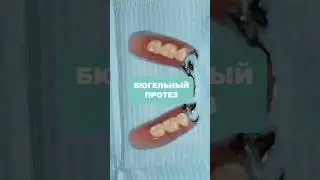 #стоматолог #протезирование #бюгель #имплантация #зуб #зубы #доктор #dentist