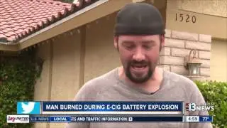 E-cigarette battery explodes in Las Vegas man's pants