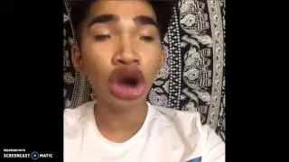 When Someone Comments About Your Over Drawn Lips
